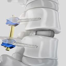 PROSPACE® 3D Oblique-Product Picture CW Enlargement