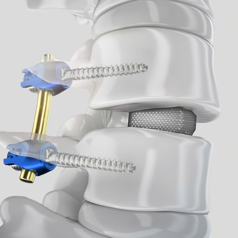 PROSPACE® 3D Oblique-Product Picture CW Enlargement